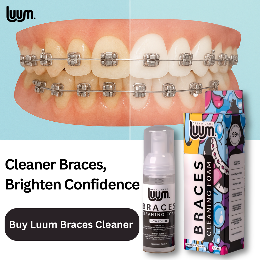 Luum Braces cleaning foam 50ml Spearmint - Image 2